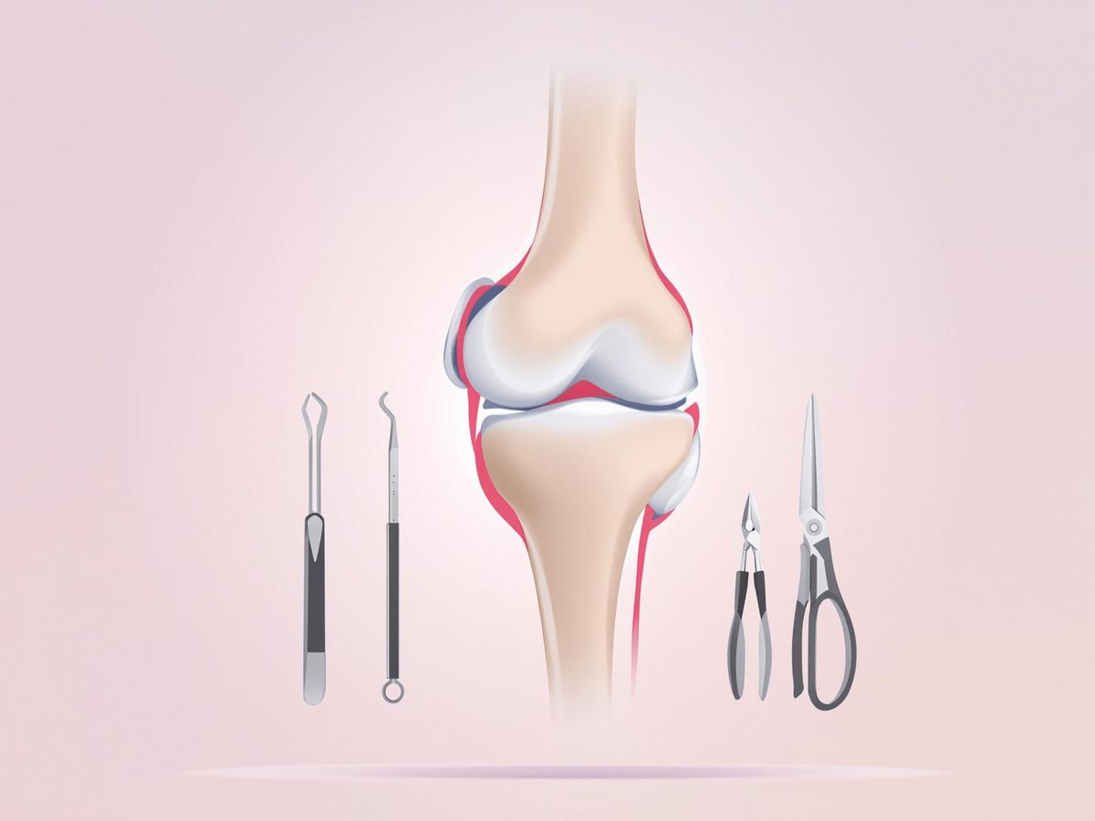 Imagem ilustrativa de cirurgia no joelho.